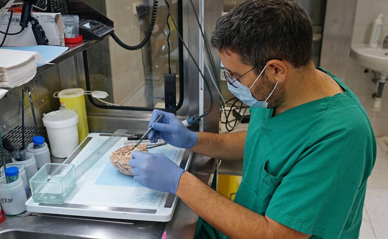El Banco de Cerebros de la Arrixaca recibe casi 300 donaciones desde su El Banco de Cerebros de la Arrixaca recibe casi 300 donaciones desde su